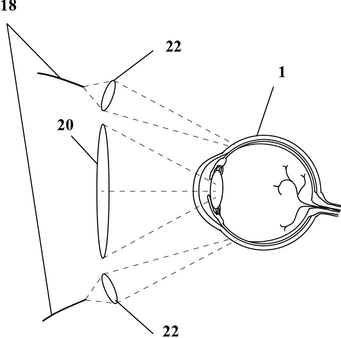 Patent granted!