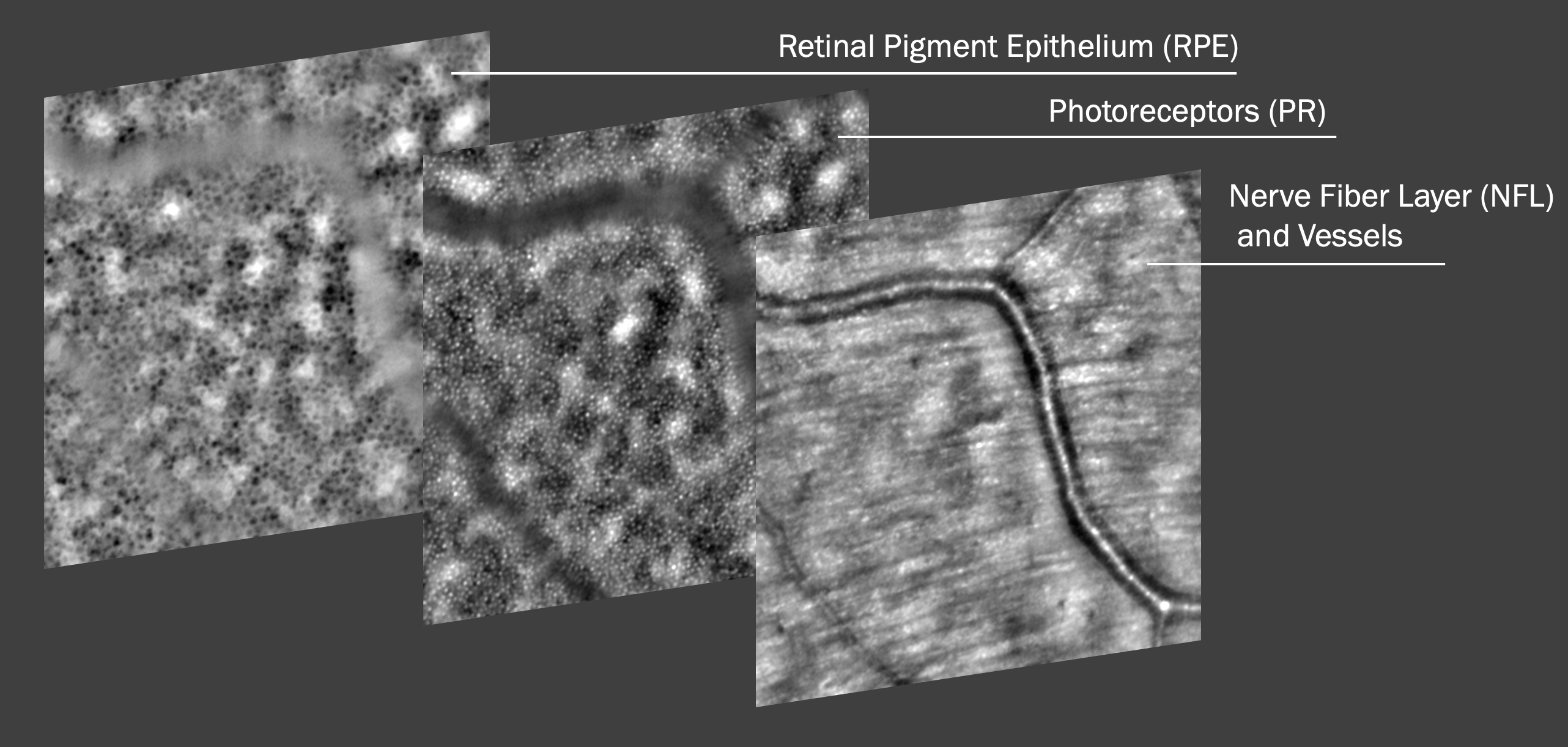 Retina Layers